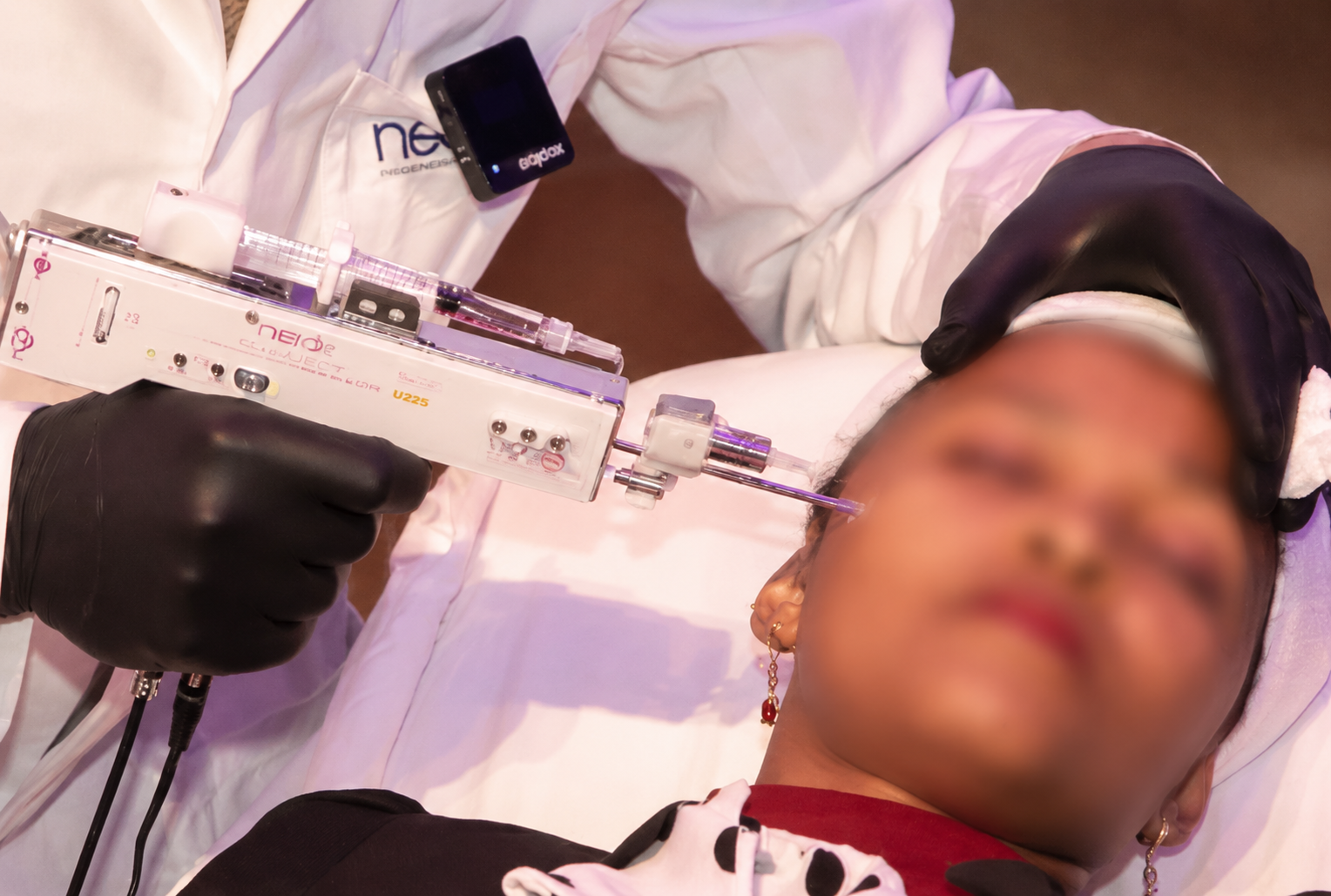 Aesthetic injectable treatment using the U225 intradermal injector